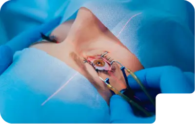 Best Eye Hospital in Kannur - Eyeris Hospital